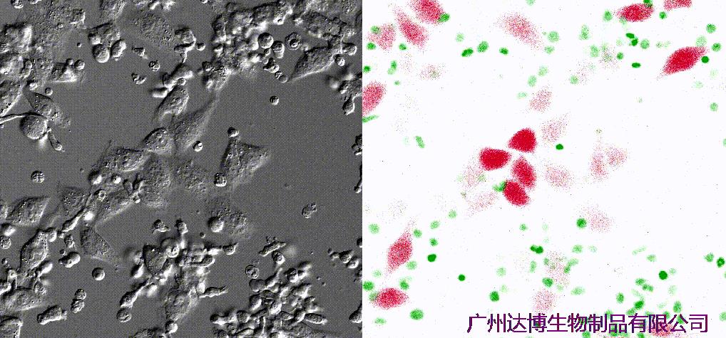 喜訊連連！達(dá)博生物“自體自然殺傷細(xì)胞注射液”獲II期臨床試驗(yàn)?zāi)驹S可