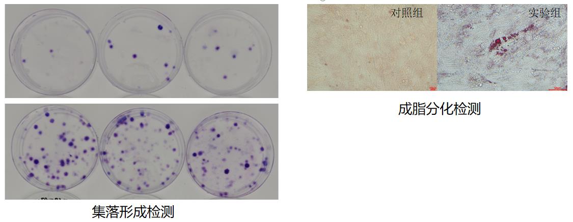 E10I的細(xì)胞增殖活性及三系分化能力