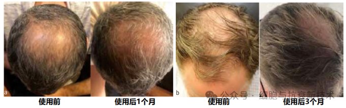 產(chǎn)品用后效果